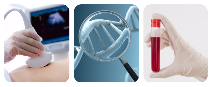 Prenatal genetic testing - Anderson Diagnostics