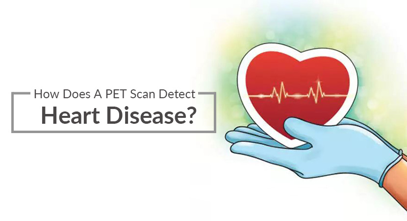 A banner image for 'PET detecting heart diseases'.