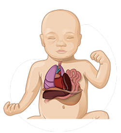 vector image of baby having hole or rift in the diaphragm