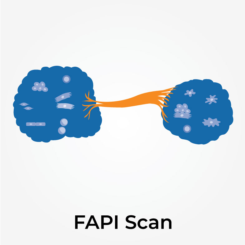 vector image of FAPI-scan