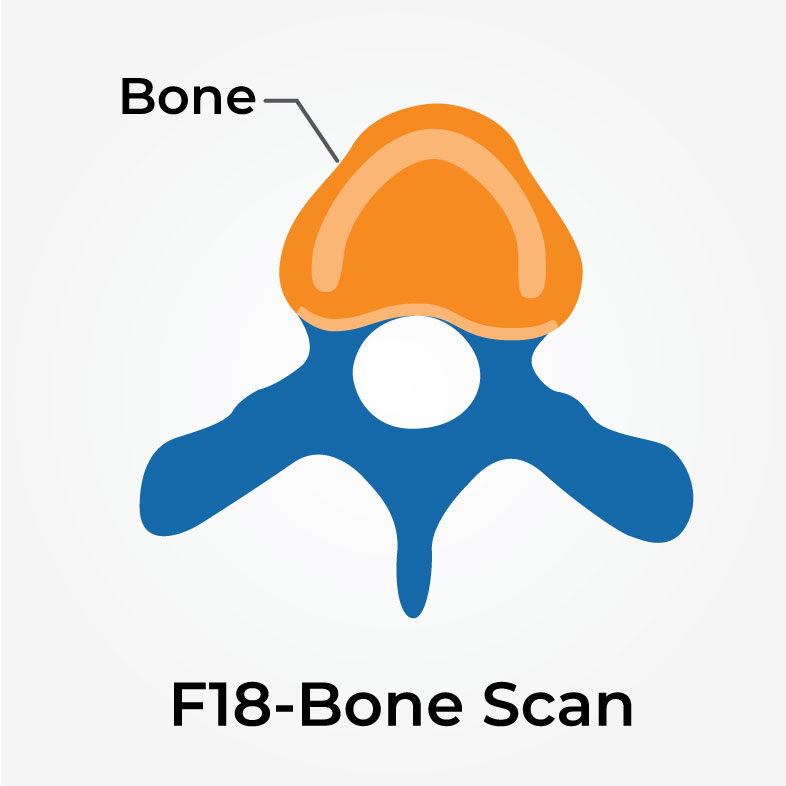 vector image of Fluoride scan