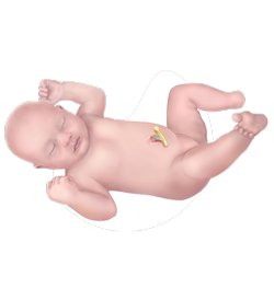 Baby having underdeveloped limbs