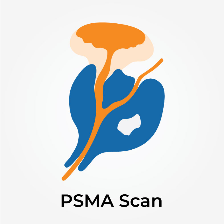 vector image of PSMA-Scan