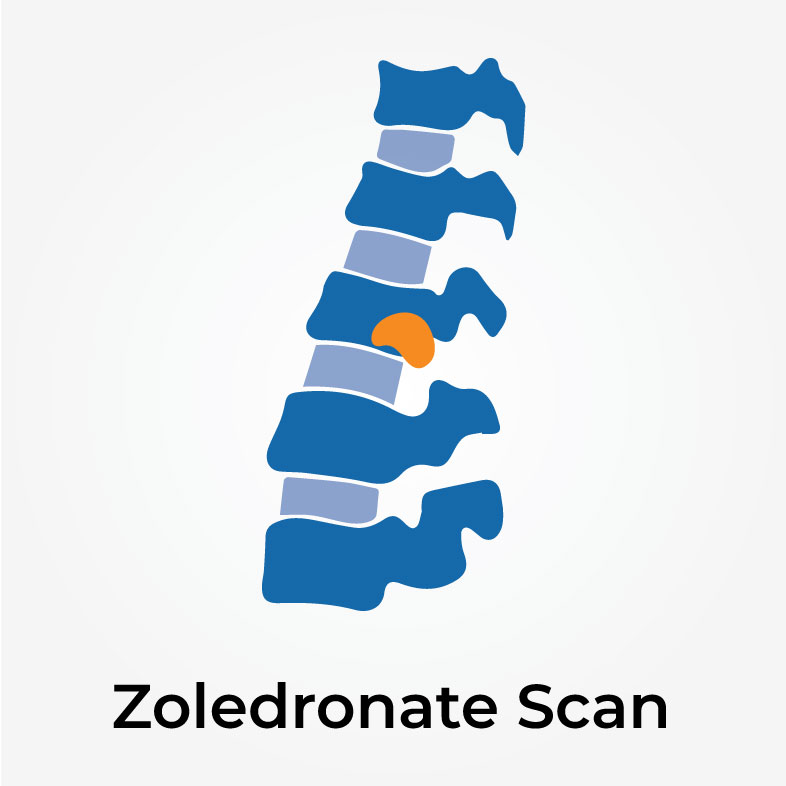 vector image of Zoledronate scan
