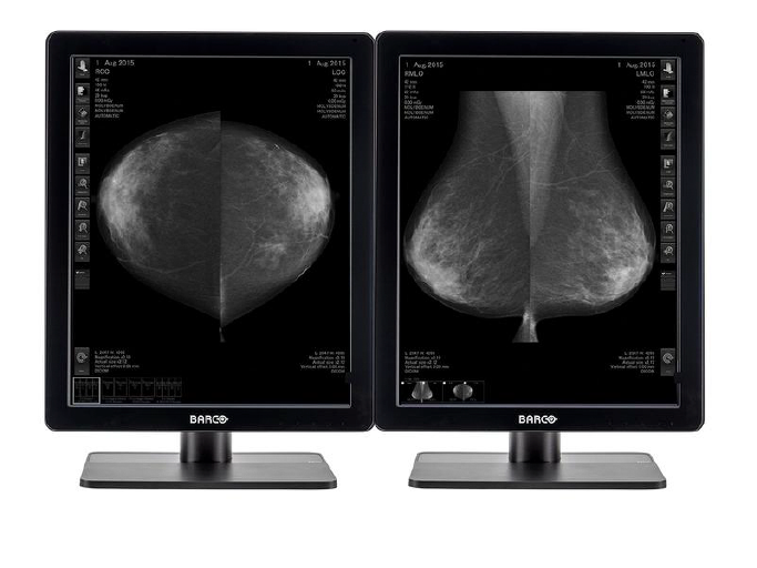 Radio imaging of female patient breast cancer diagnosis is displayed on the two Barco Monitors
