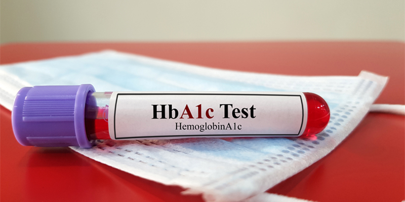 A laboratory sample tube of blood for hemoglobin A1C test (HbA1C) illustrates the HbA1c testing.